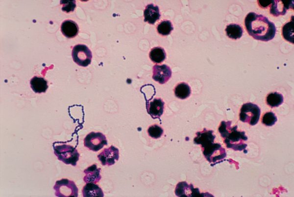 Streptococcus Viridans